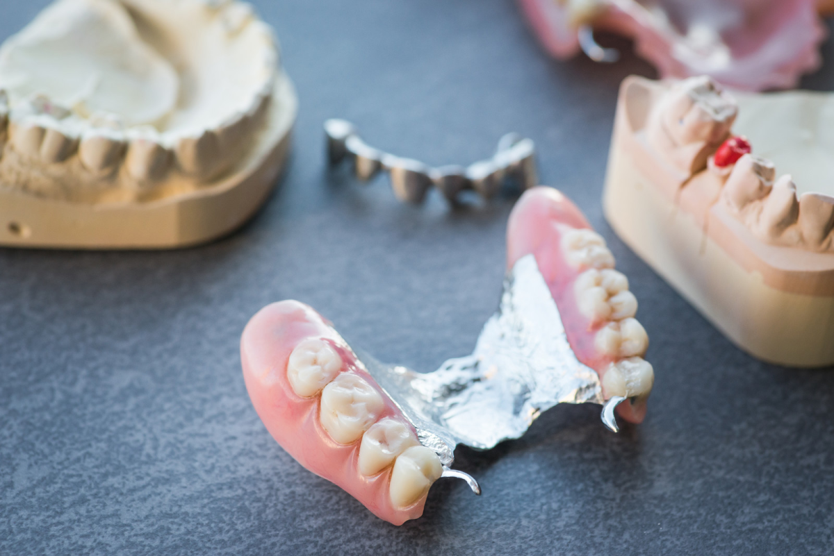 How Often Should Dentures Get Relined?